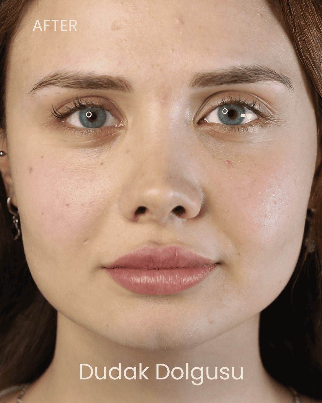 ezgi doğan polikliniği