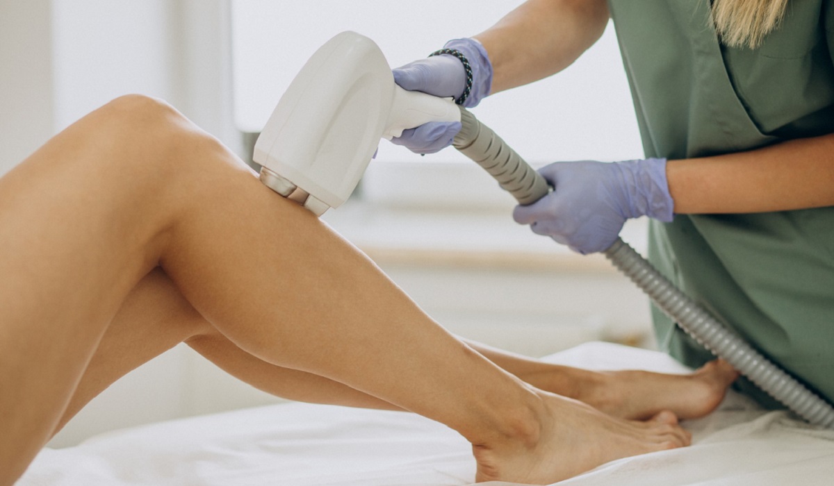 Lazer Epilasyon Rehberi