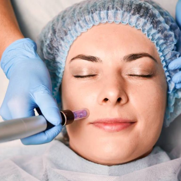 Dermapen İşlem