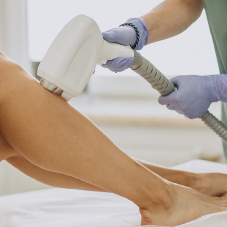 Lazer Epilasyon Rehberi